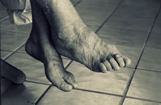 O Podologista pode tratar vários problemas da saúde dos pés, assim como uma análise detalhada de forma a ajudar na prevenção de outros problemas que possam surgir.